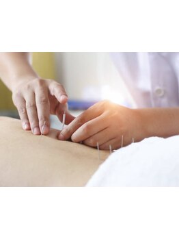 鍼灸施術を受けたい