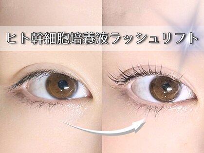 シィ(Sii)の写真