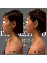 エミナル(EMINALu)/知識と技術☆細かくひもほどく