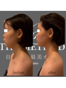 エミナル(EMINALu)/知識と技術☆細かくひもほどく