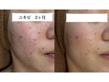 ジューンブライド(June Bride 61)/ブライダルエステ