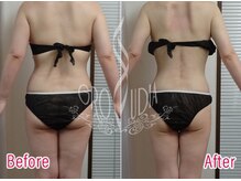 グラウディア 恵比寿/痩身/筋膜リリース/ブライダル