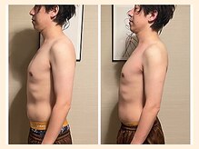 ラフリー 仙台院(RUFFREE)/肩こり改善に肩甲骨はがし