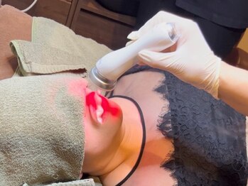 ビューティーエー(Beauty I)の写真/【話題沸騰☆】フェムケア本格専門エステ!韓国発の黒ずみケア♪バイミュリー導入店★低刺激で肌に優しい◎