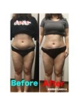 ユメカ 日の出院(YUMEKA)/骨盤ダイエット+骨盤ストレッチ