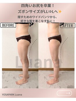 ヨサパーク ルアナ 高島店(YOSA PARK Luana)の写真/＼下半身集中も当ダイエットサロンで／凝り固まって太くなった太もも・ヒップのお肉に集中アプローチ！