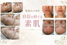 りりあす