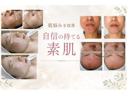 りりあすの写真