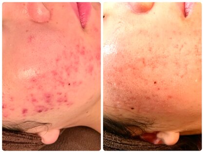 ビーアンドアイ シズオカテン レディース(B＆I SHIZUOKA)の写真