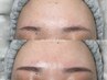 【アイブロウワックス脱毛】骨格に合わせ自然と美しい眉に