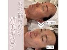 マインエム(mine.m)の雰囲気（お悩みに合わせて韓国院長監修アンプル導入贅沢コース！大人気）