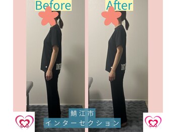 腰の整体インターセクション/美容整体【横】