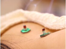 なみつき鍼灸整骨院の雰囲気（【施術歴30年の実績】お灸で女性特有のお悩みを根本改善！）