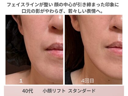 リアン(Lien)の写真