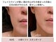リアン(Lien)の写真