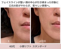 リアン(Lien)
