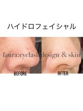 ファウラ(faura:)/ハイドロフェイシャル
