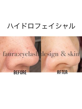ファウラ(faura:)/ハイドロフェイシャル