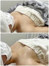 シアンビビ(Cyaan bibi)/バストアップ