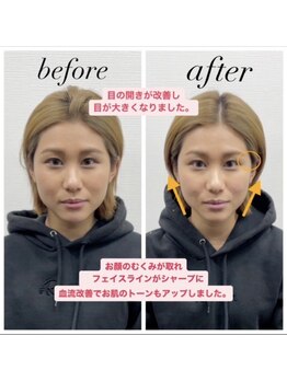 きらめき鍼灸治療院/即効性あり!1回でたるみ改善♪