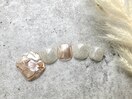 PG010095665