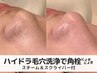 【毛穴超超超ごっそり◎】ハイドラ毛穴洗浄全顔×人気美容液フル導入