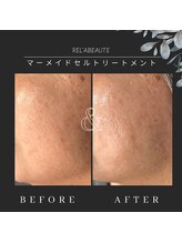 ルルマル(lulumalu)/マーメイドセルトリートメント