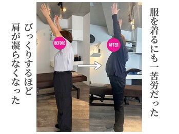 エボニー(Ebony)/肩が痛くて服を着るのに一苦労