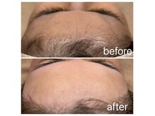 ワクシングアンドビューティーワイ(Waxing&Beauty_Y)の雰囲気（顔の産毛は《フェイシャルワックス》で解決★垢抜けしたい方も◎）