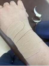 高田馬場名倉堂鍼灸接骨院/手首のテーピングです