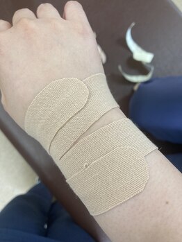 高田馬場名倉堂鍼灸接骨院/手首のテーピングです