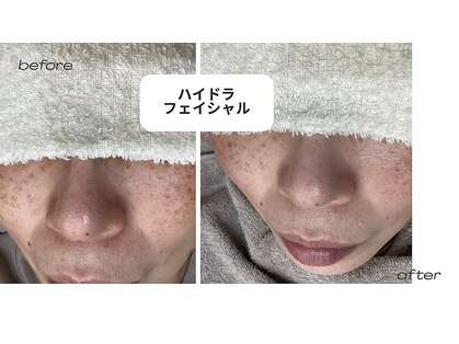 ルピアス(Lupias)の写真