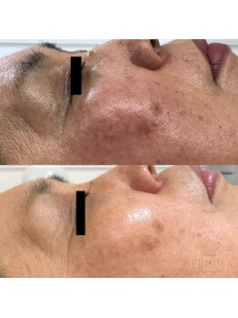 パルファンカルム 駅西本町店/次世代ハーブで効果実感!