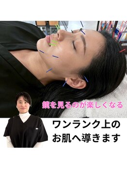 リュウ整骨院(Ryu整骨院)/美容鍼
