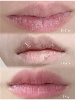 ココノワ(coconoix)/ローマピンク唇