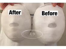 美極 トータルビューティー(美極 TOTAL BEAUTY)/恵比寿/小顔コルギ/エステ/