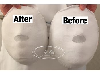 美極 トータルビューティー(美極 TOTAL BEAUTY)/恵比寿/小顔コルギ/エステ/