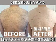 CBD でストレス軽減やリラックス効果を！美容×健康を応援します