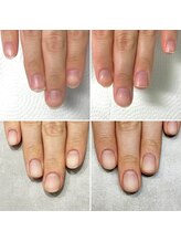 ネイルズシャトン/育爪ジェルコース