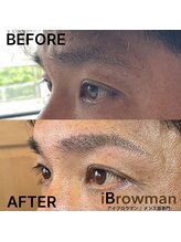 アイブロウマン(i Browman)/施術イメージ