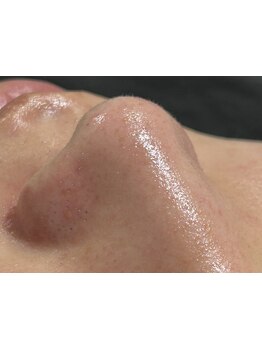 毛穴ケアをしたい