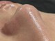 アウラプラス(Aura+)の写真/駅チカだから通いやすい◎４０種類の美容成分で毛穴汚れをごっそり落としましょう！