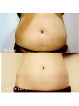 エステティック ザザ 神楽坂店(ZA/ZA)/サーモシェイプボディの結果