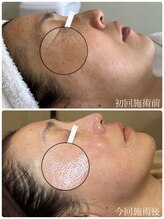 トイボーテ(toi beaute)/エイジングのお悩みに効果的♪