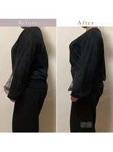 エスプリクレール(Esprit Clair)/【札幌・西28丁目】巻き肩改善