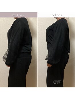 エスプリクレール(Esprit Clair)/【札幌・西28丁目】巻き肩改善