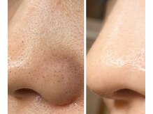 before⇒after長年のお悩みも驚きの効果を実感！