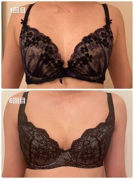 美人バスト 新潟店/ 【バストアップ★育乳】症例