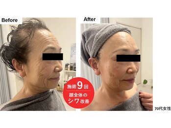 ファームディ(Pharm.D)/肌年齢は若くなります!