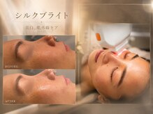 ビュウナ 銀座(BEAUNA)の雰囲気（紫外線ダメージをケアし、美白潤い肌へ！）